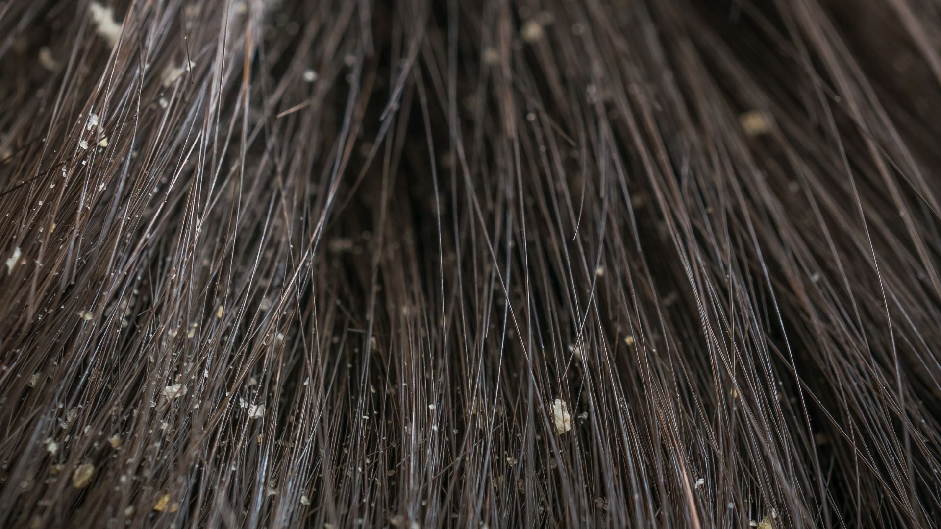 Understanding Sebum, Malassezia, and Inflammation in Scalp Irritation