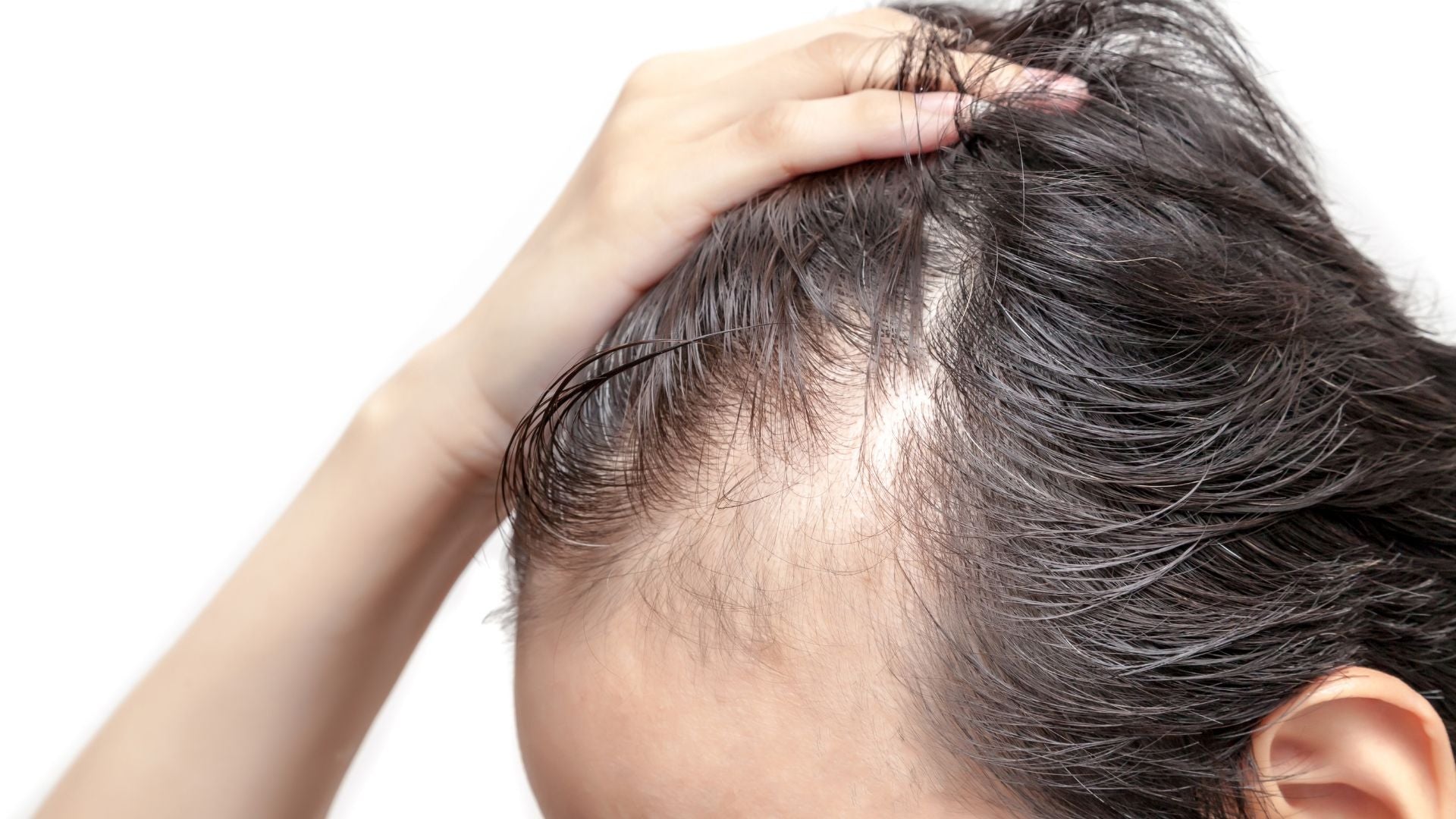 Scarring vs Non-Scarring Alopecia: Diagnosis, Treatment, and Prevention Pathways