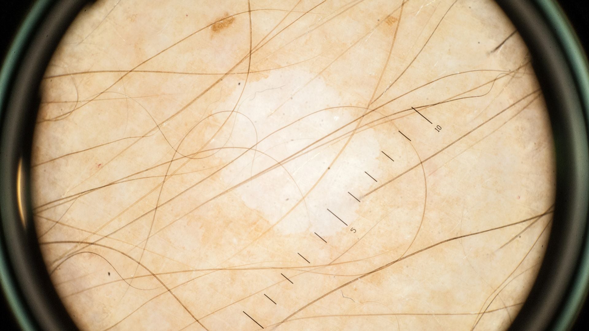 Measuring Scalp Inflammation: How Experts Assess Sensitivity and Healing Progress