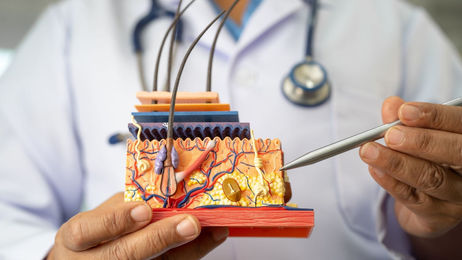 Follicular Occlusion and Fibrosis: How Blocked Follicles Lead to Scarring