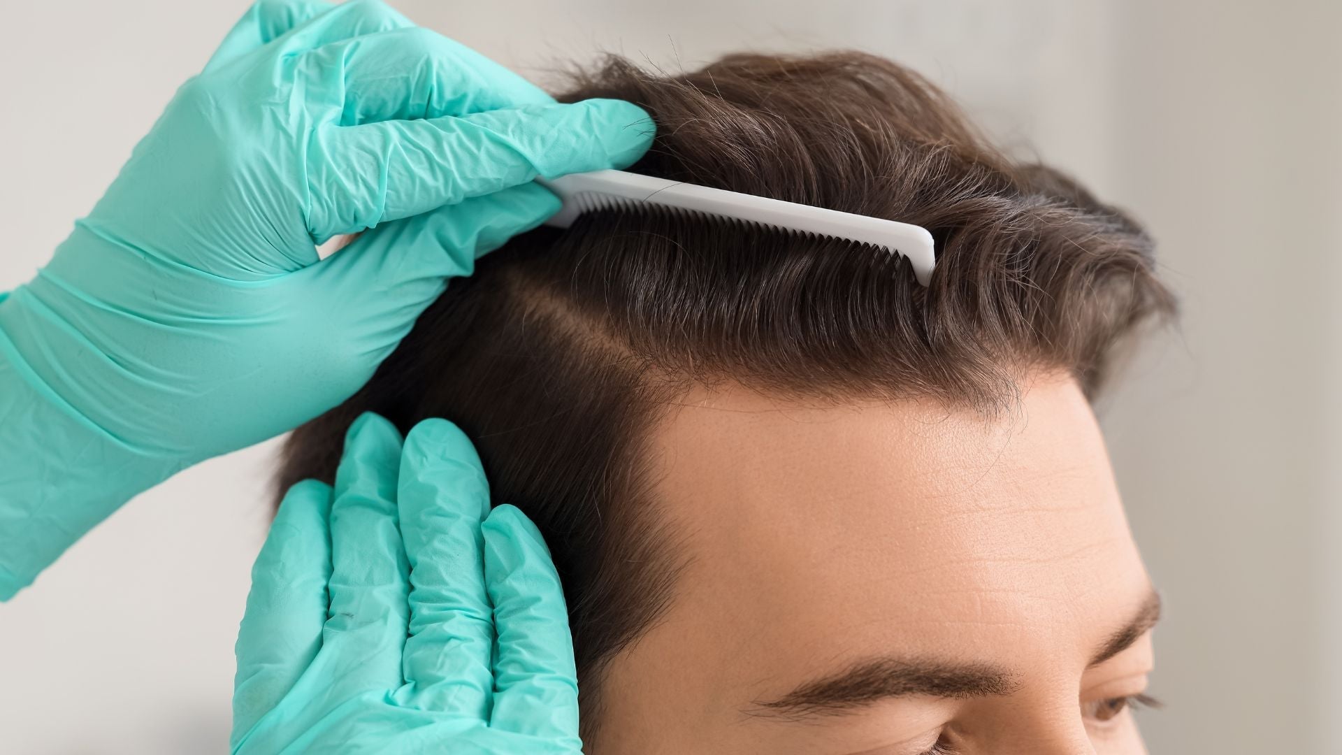 Understanding Follicular Unit Anatomy and Its Impact on Scalp Health