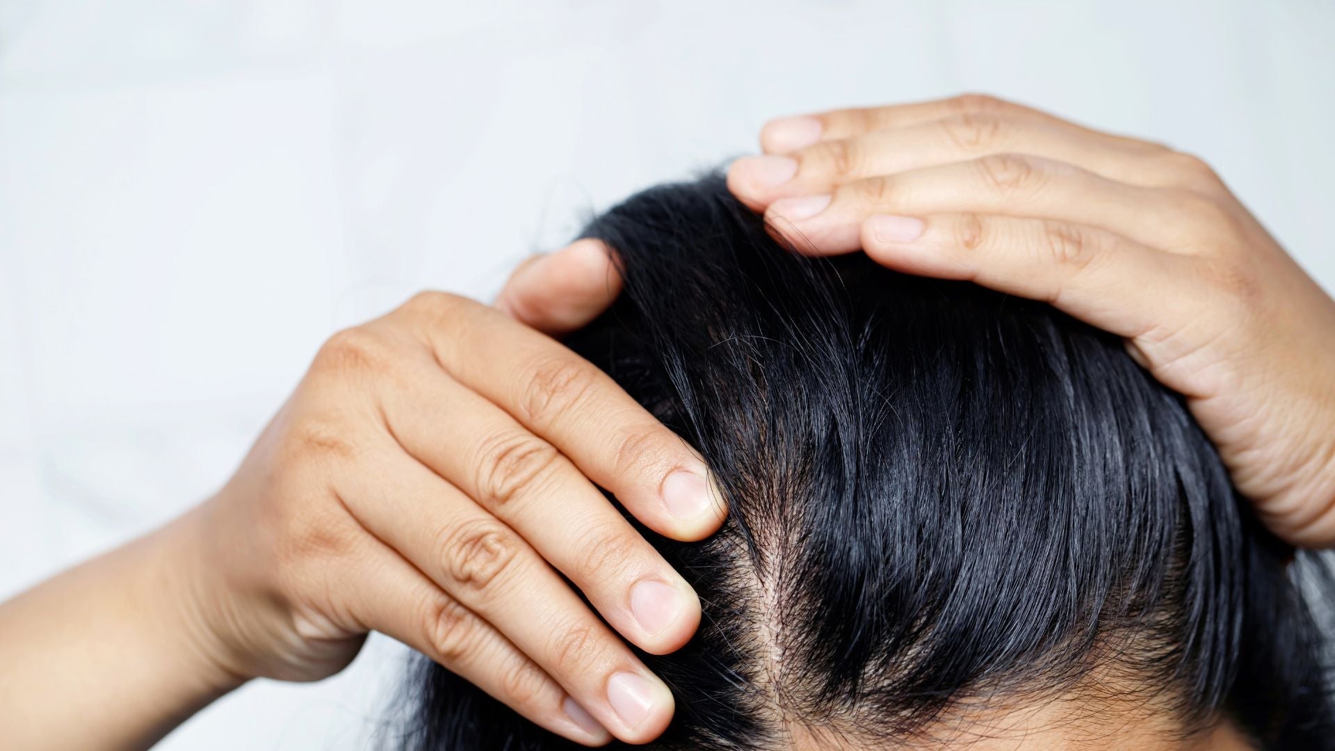 Irritant vs Allergic Contact Dermatitis: What Your Scalp is Telling You