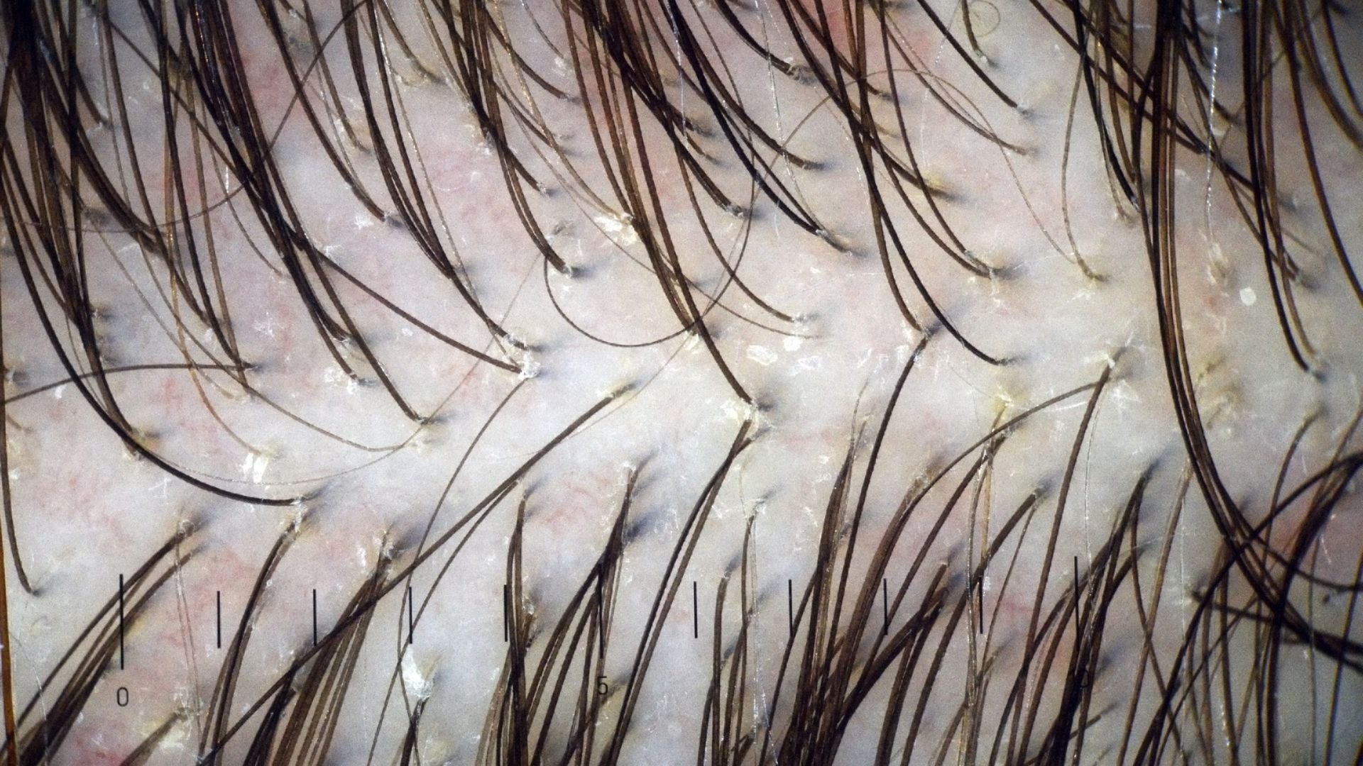 Measuring Scalp Barrier Health: The Science Behind Sensitivity and Repair