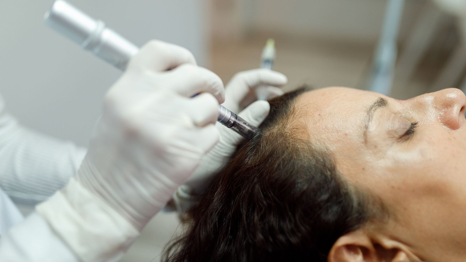 Microneedling for Hair Growth: Common Mistakes That Harm Scalp Health  The  Better Scalp Company