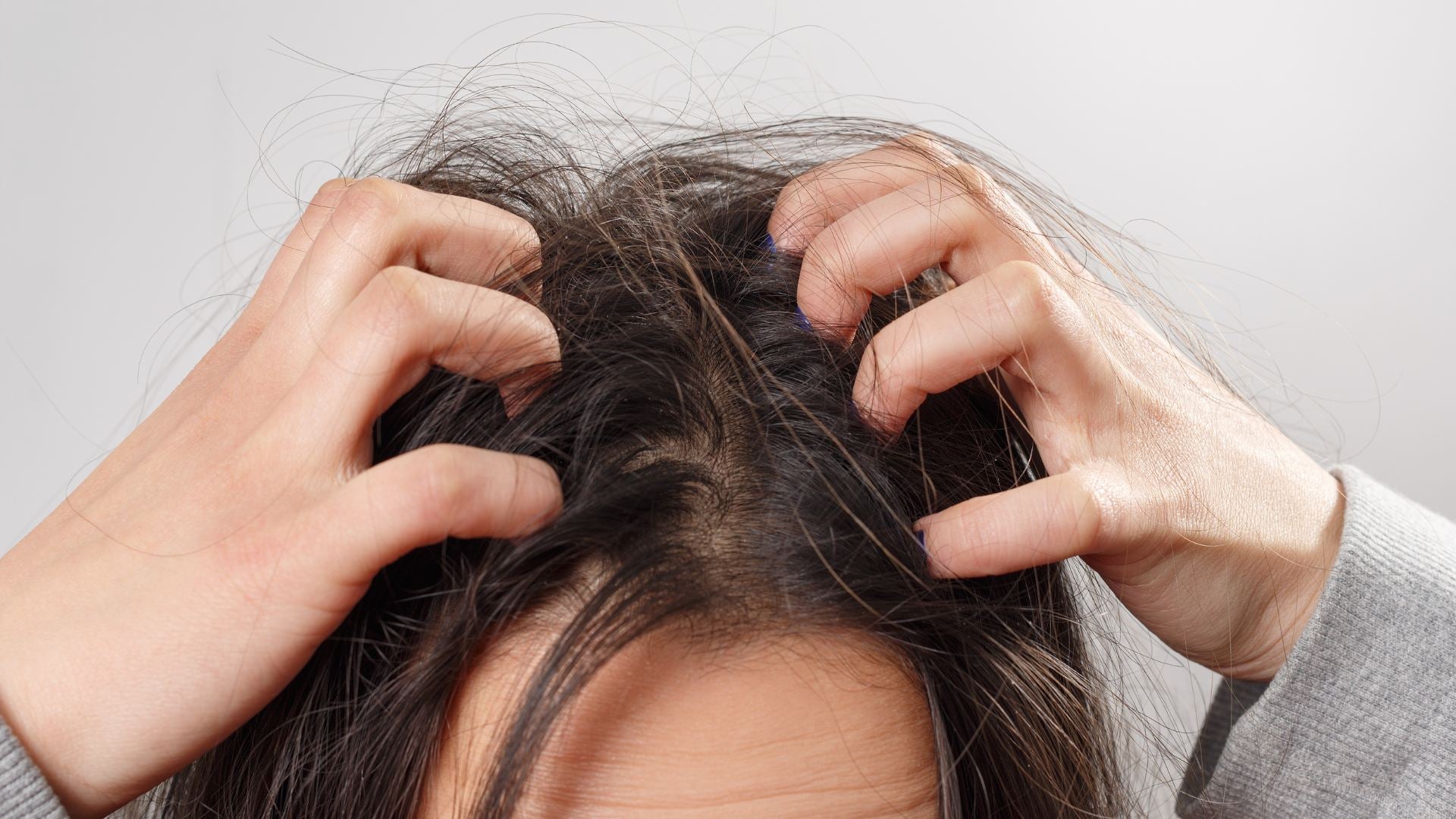 How to Naturally Calm and Avoid an Itchy Scalp: Effective Herbal Remedies and Care Tips