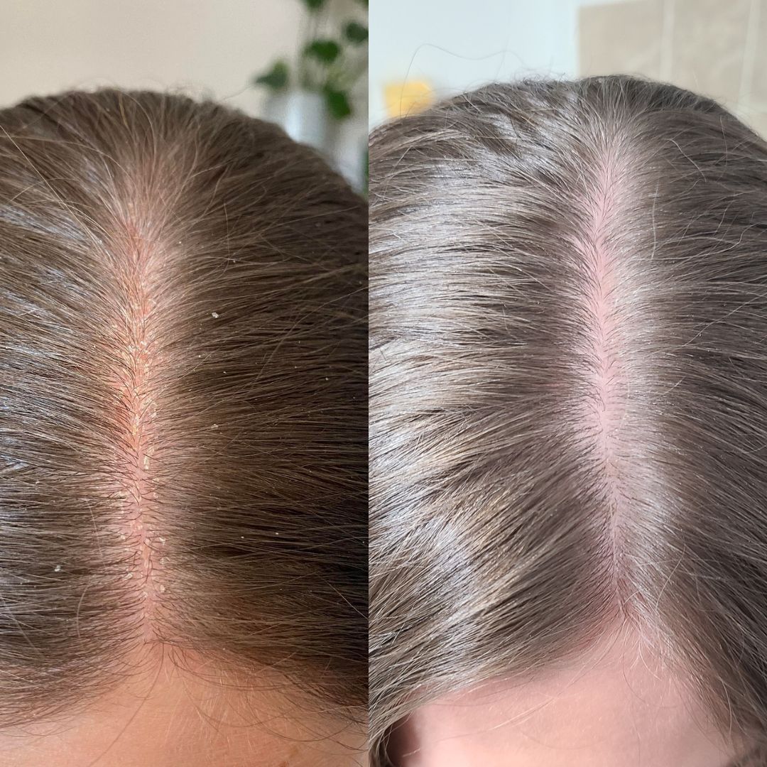 Sensitive Scalp Conditioner