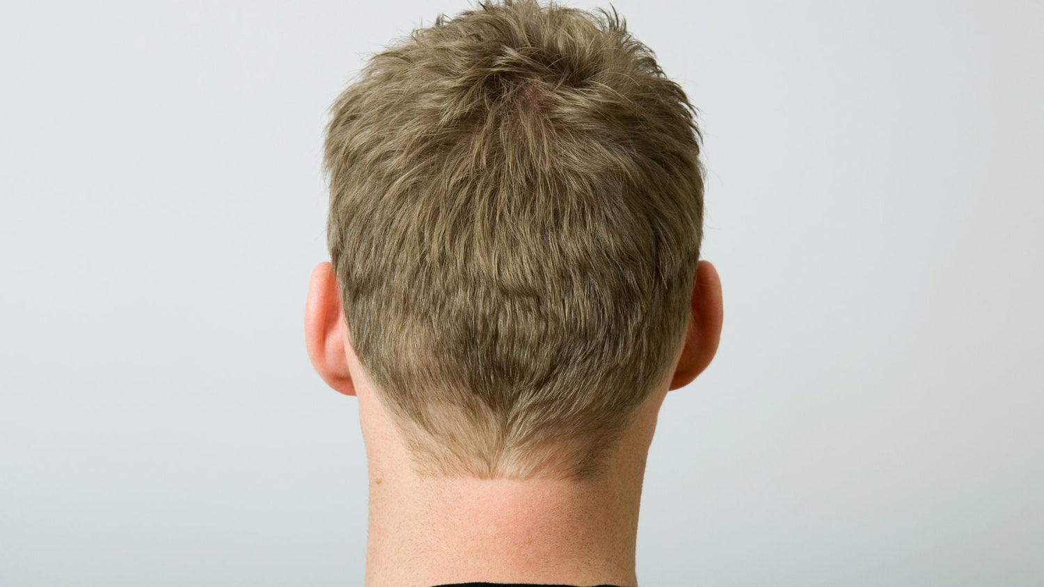 Scalp Microbiology and Sensitivity: How Microbes Influence Scalp Health