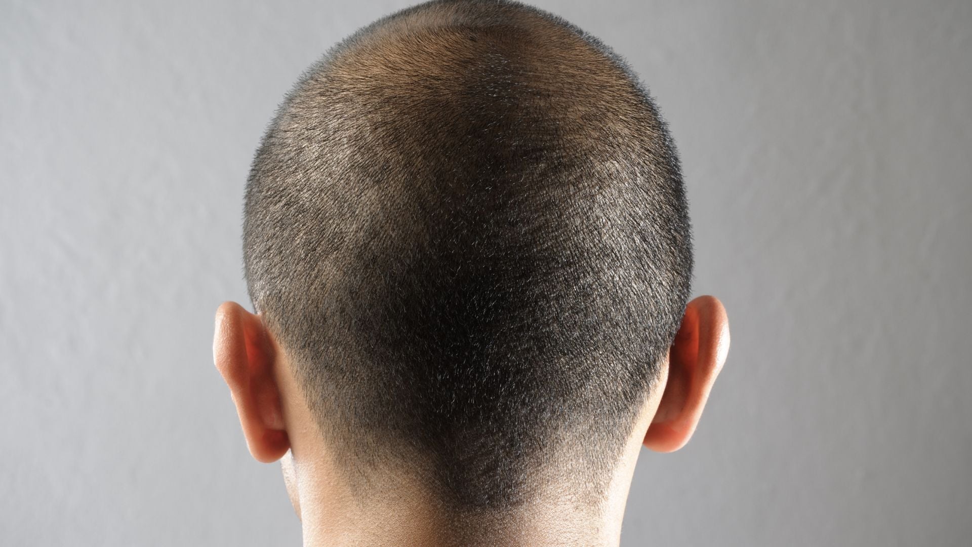 Scalp Itch Relief Timelines: How Treatments Deliver Comfort Over Time