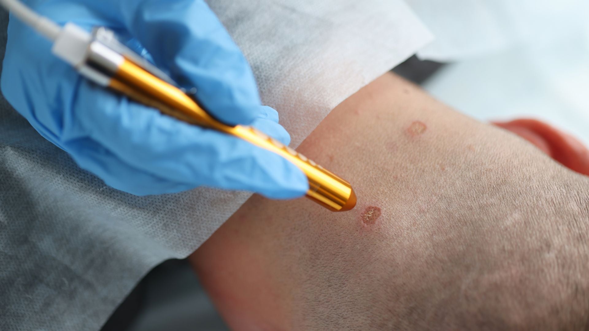 Scalp Diagnostic Workflow: From Trichoscopy Findings to Biopsy Confirmation