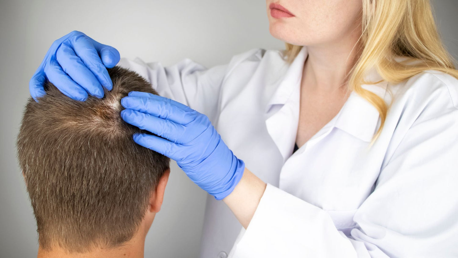 Scarring Alopecia Treatment Roadmap: How Early Care Prevents Permanent Hair Loss