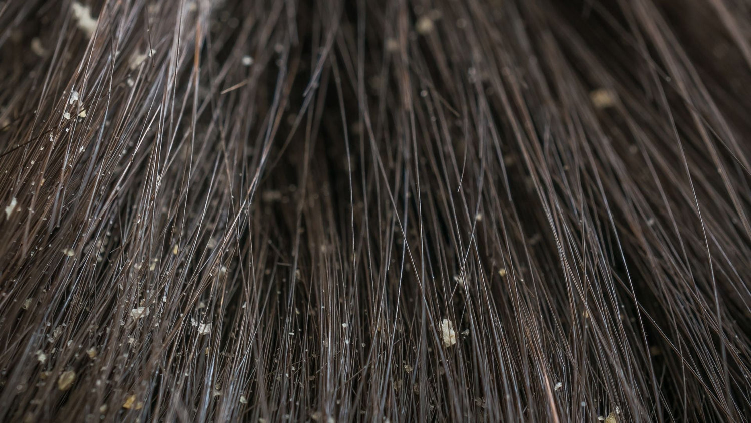 Understanding Sebum, Malassezia, and Inflammation in Scalp Irritation