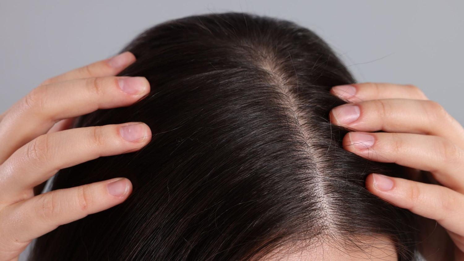 Scalp Health Triad: Host, Microbes, and Environment Explained