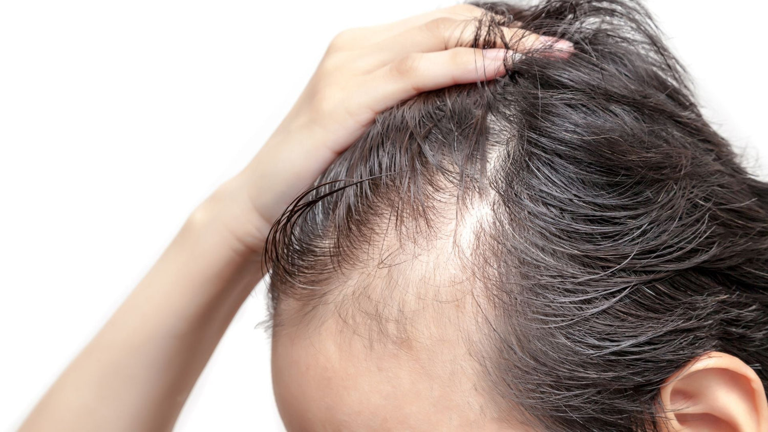 Scarring vs Non-Scarring Alopecia: Diagnosis, Treatment, and Prevention Pathways