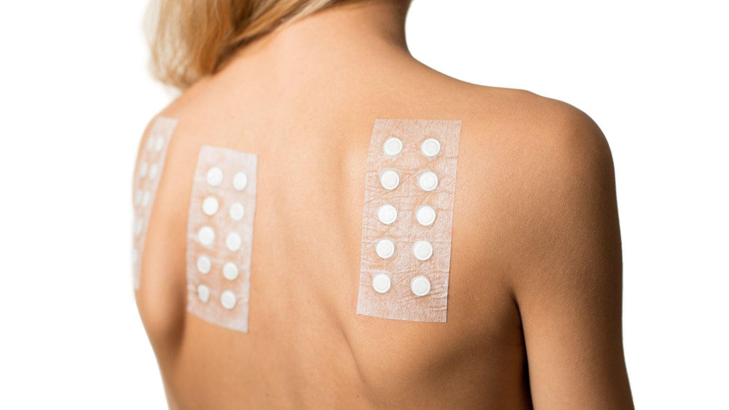 Patch Test Guide for Sensitive Scalps: Preparation, Results, and Care