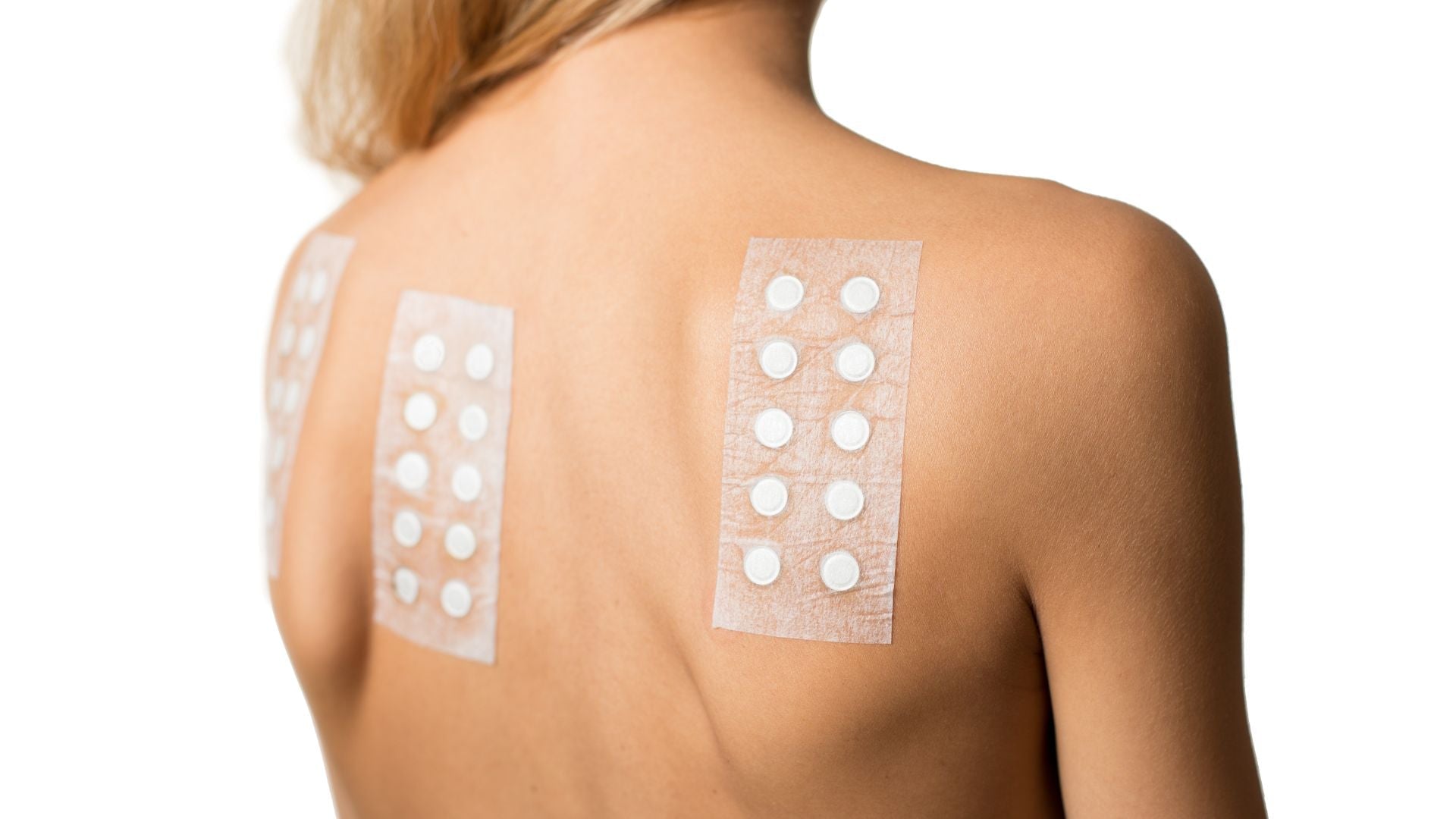 Patch Test Guide for Sensitive Scalps: Preparation, Results, and Care