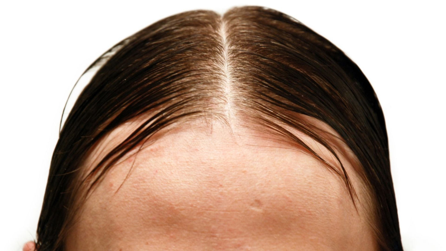 Sebum Balance Strategies: Restoring Scalp Barrier Health in Oily Hair