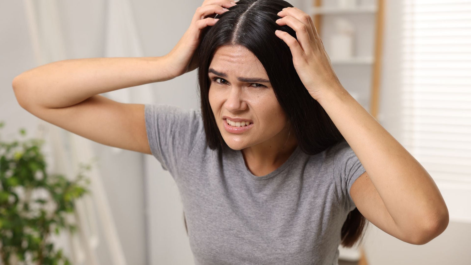 Differential Diagnosis for Sensitive Scalp: Distinguishing Dandruff, Dermatitis, and Psoriasis