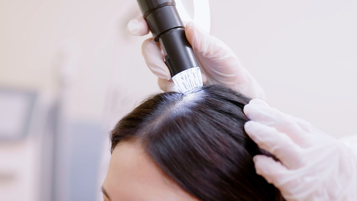 Tinea Capitis Explained: From Early Signs to Complete Scalp Healing