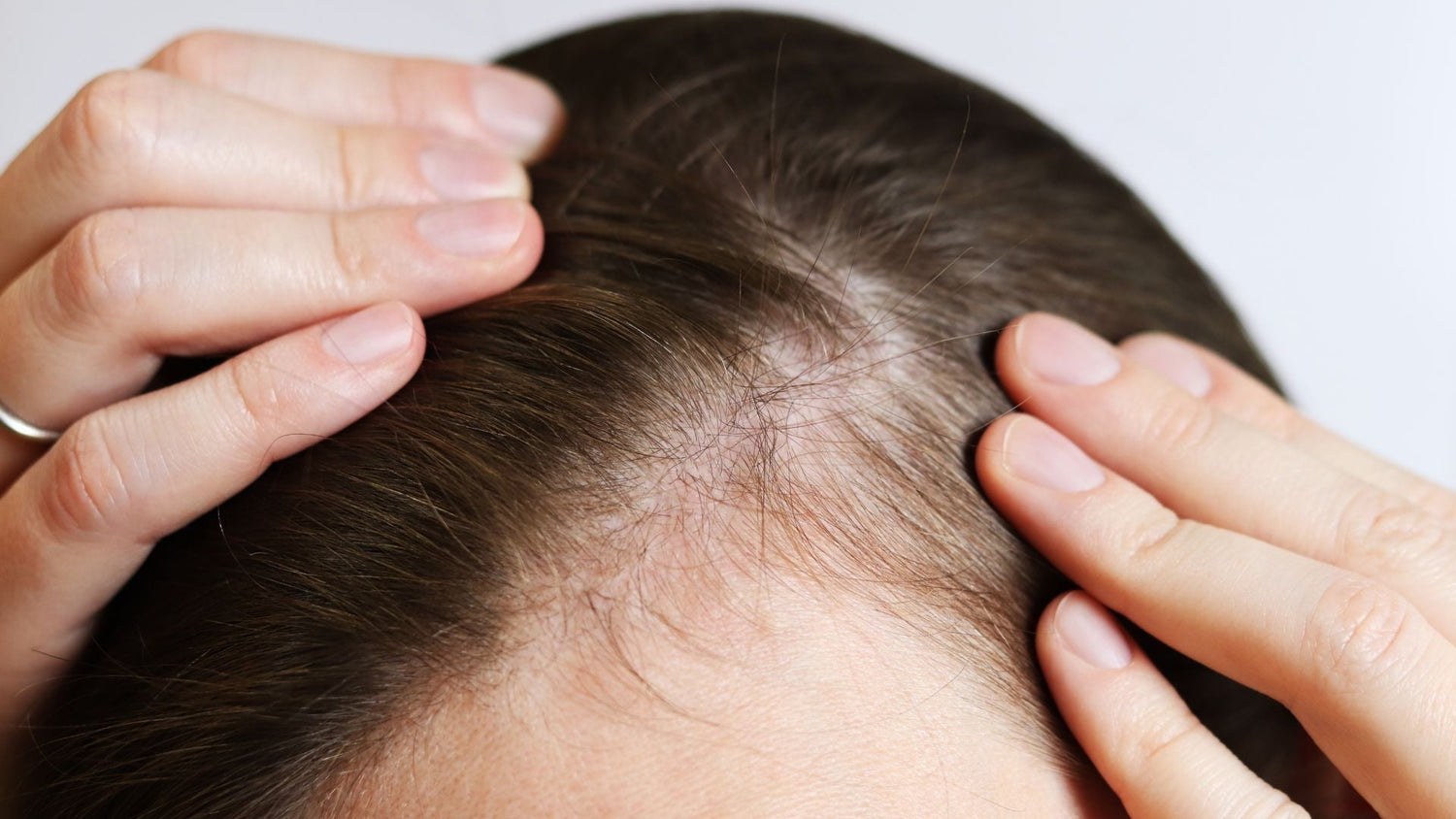 How the Scalp Barrier Supports Hydration, Comfort, and Hair Health