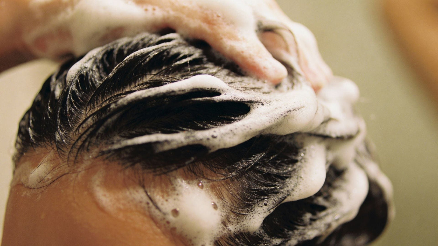 Color-safe psoriasis shampoo: The Chromatic Calm Protocol for Scalp Plaque Control