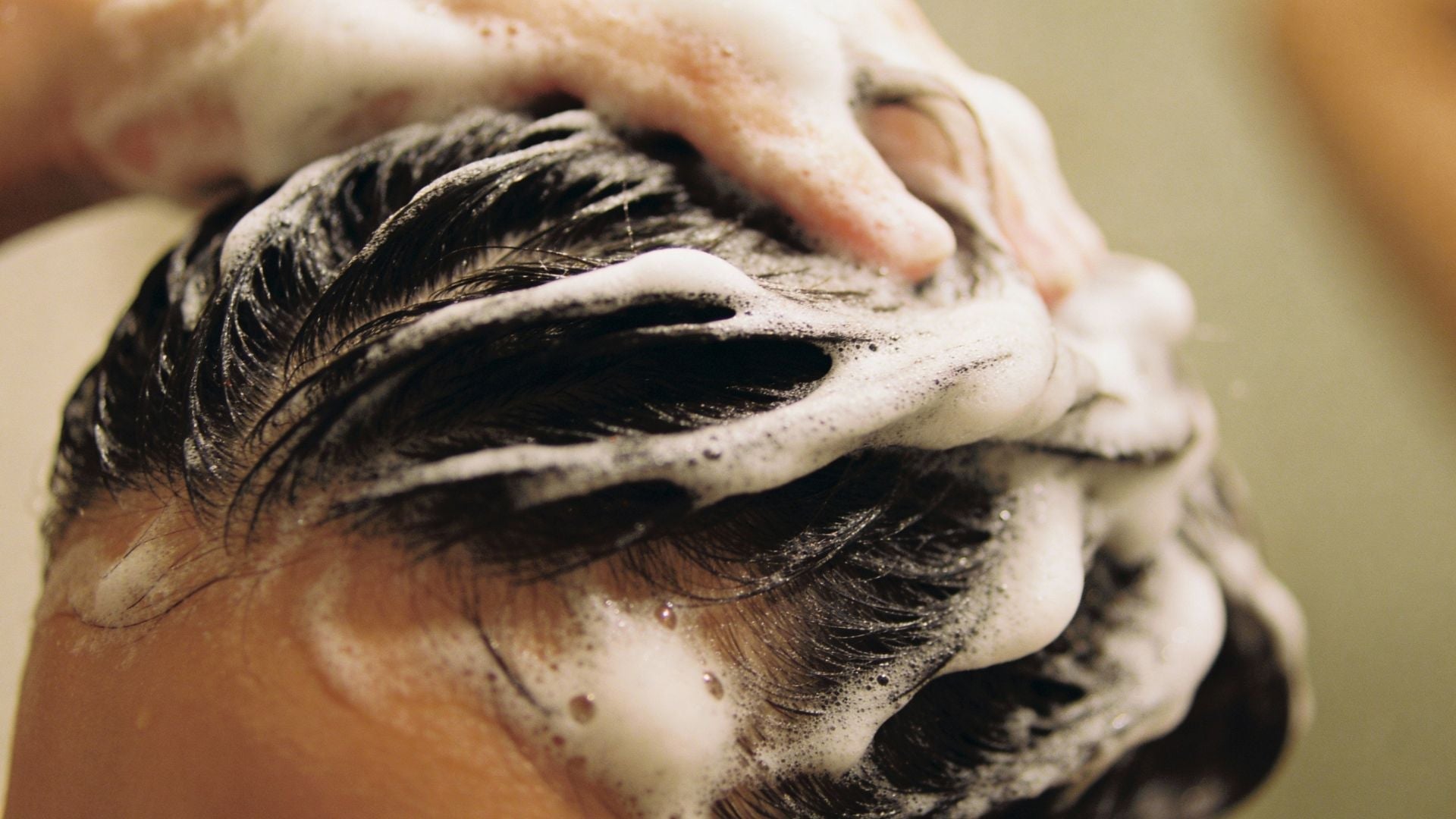 Color-safe psoriasis shampoo: The Chromatic Calm Protocol for Scalp Plaque Control