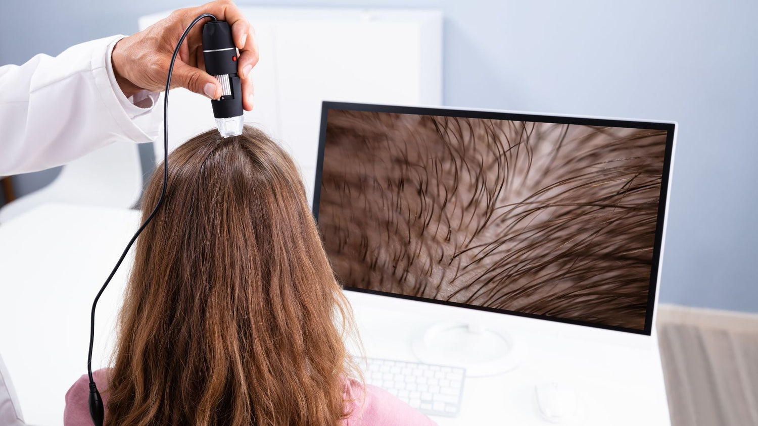 Sensitive Scalp: When to See a Dermatologist or Self Treat