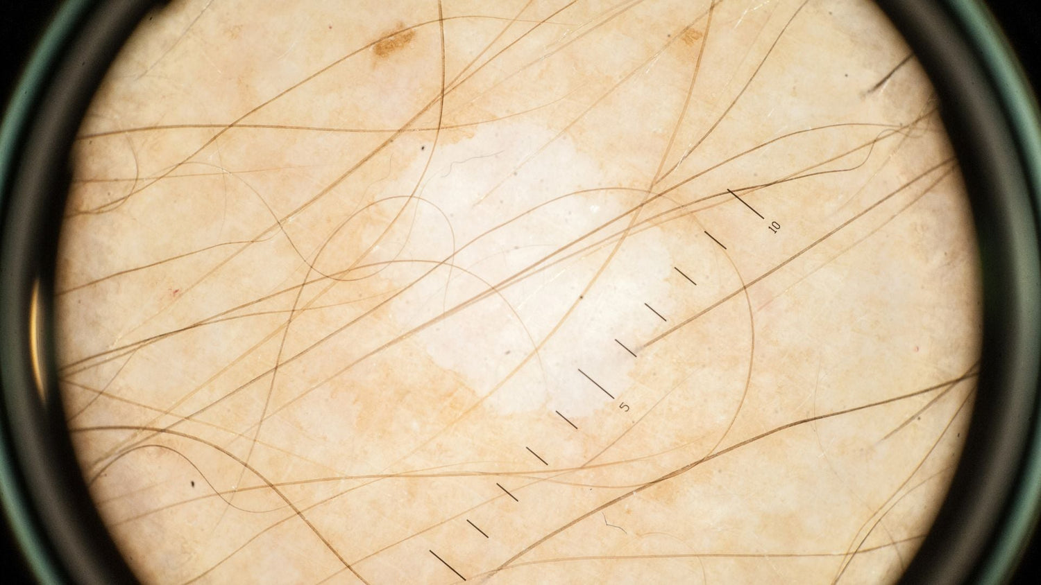 Measuring Scalp Inflammation: How Experts Assess Sensitivity and Healing Progress