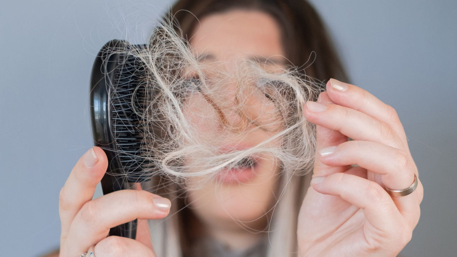 Telogen Effluvium vs Androgenetic Alopecia: Understanding Sudden vs Patterned Hair Loss