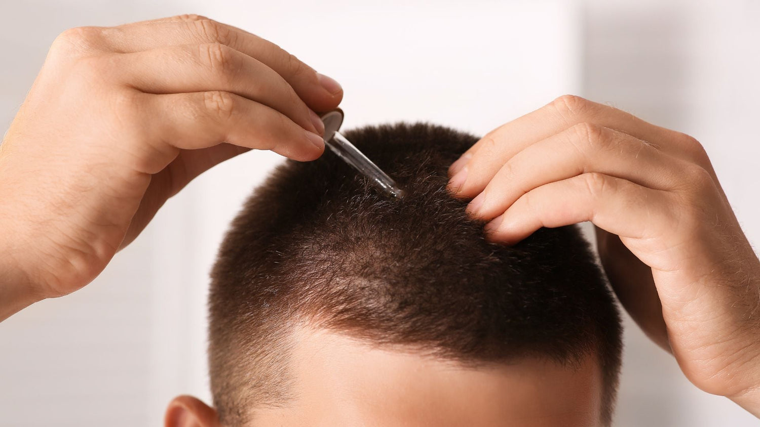 Minoxidil, finasteride, steroid injections: mechanisms and sensitive scalp safety
