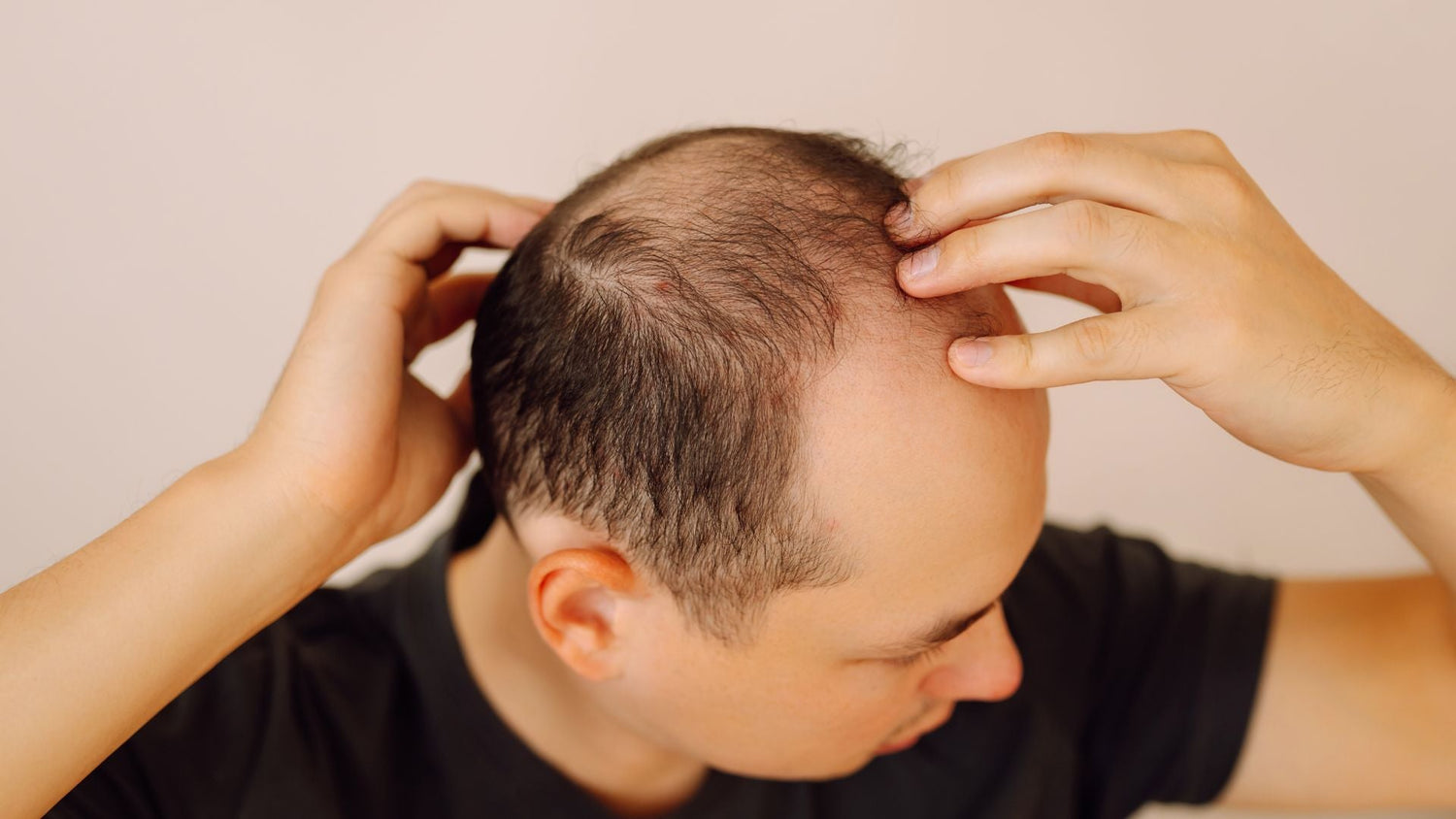 Light Therapy for Sensitive Scalps: Comparing Clinic Phototherapy and At-Home LED Treatments
