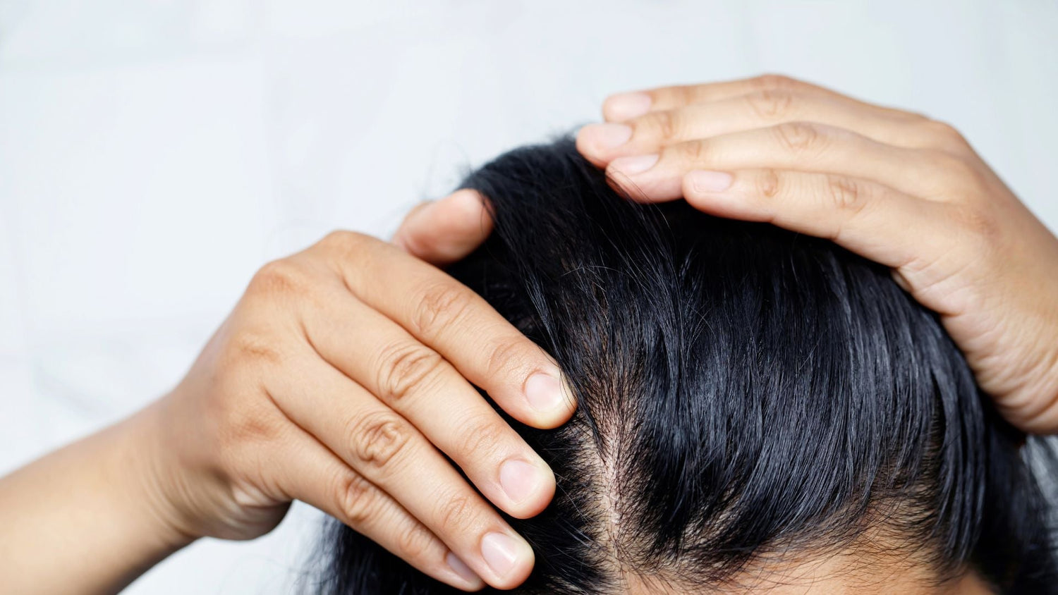 Irritant vs Allergic Contact Dermatitis: What Your Scalp is Telling You