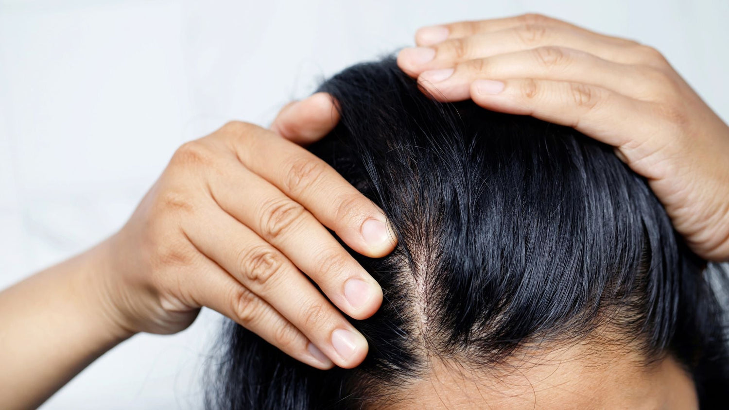 Sensitive Scalp Symptoms: Identify Causes and Choose Safe Treatments