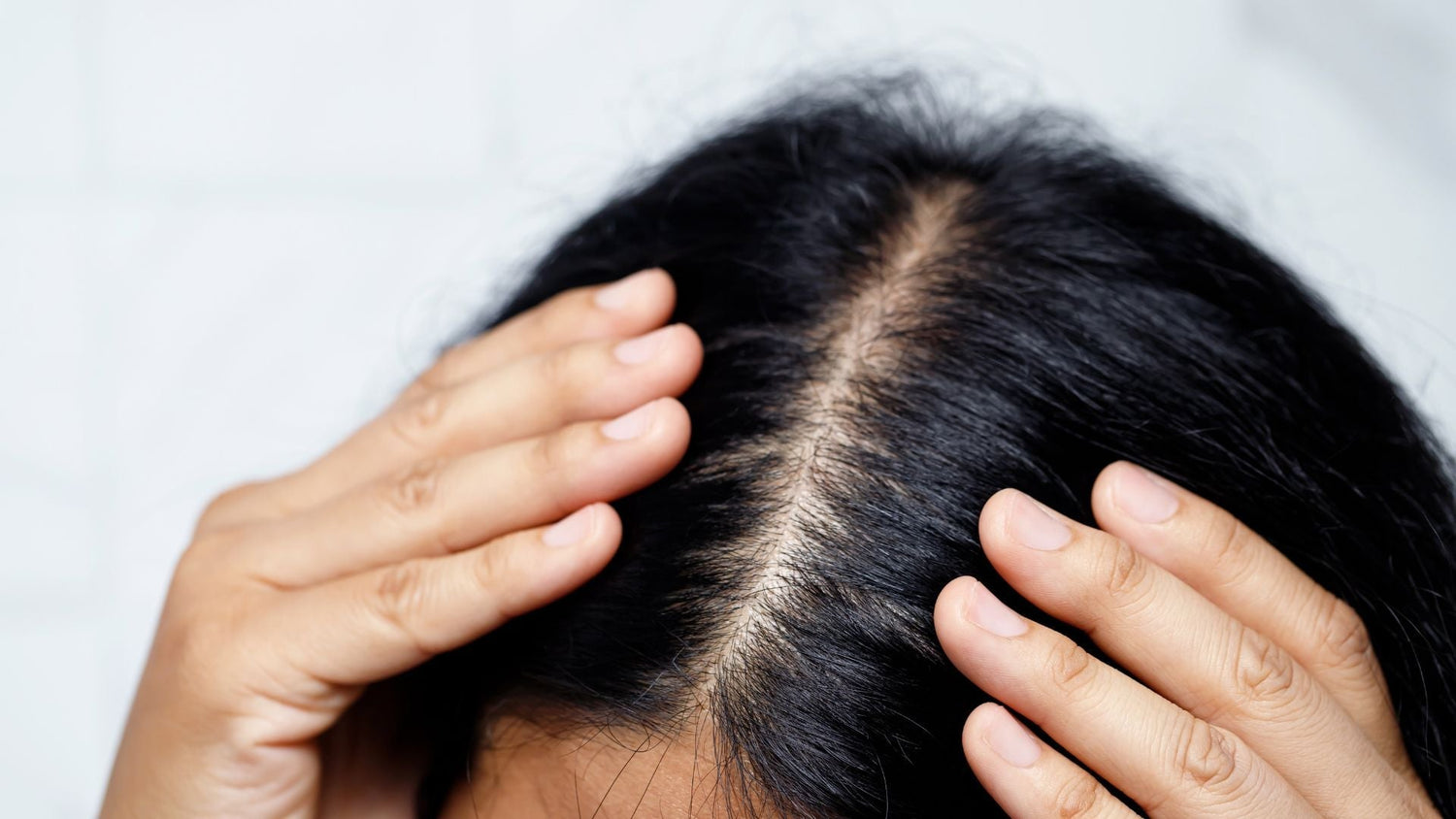 Sensitive Scalp Care: From Symptom Tracking to Dermatology Referral
