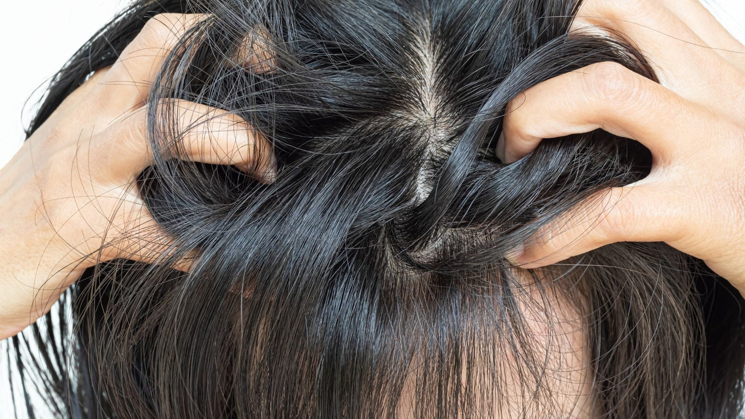 What Sebum and TEWL Levels Reveal About Sensitive Scalps