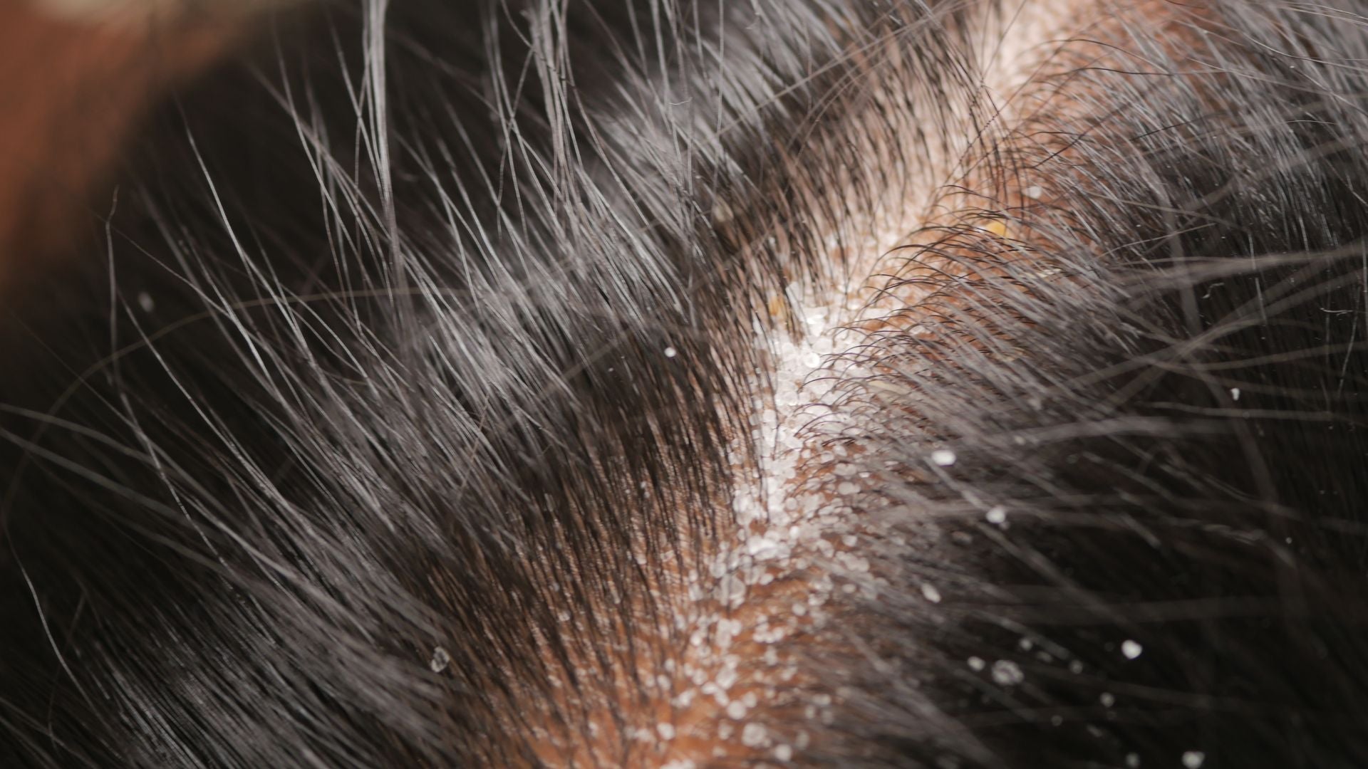 Sensitive Scalp Treatment Safety: Profile-Based Vetting to Prevent Flares
