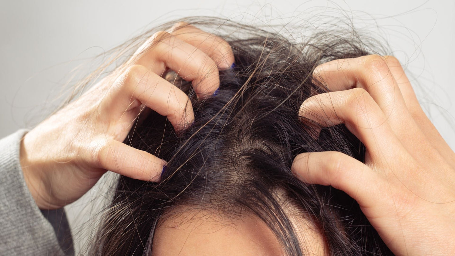 14-Day Scalp Trigger Reset: Calm, Clarify, and Rebuild Barrier Health